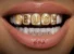 Masicka – Rich Sex ft. Rvssian